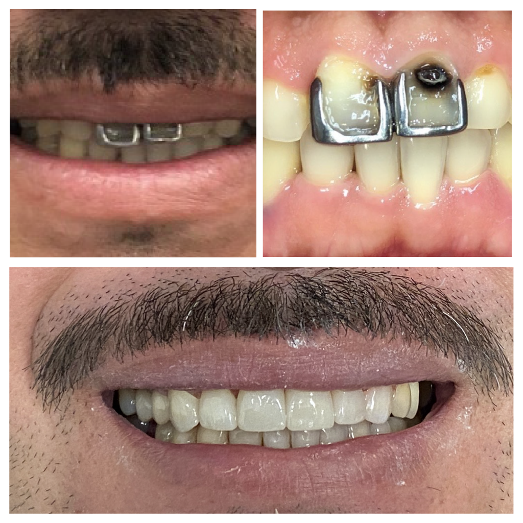 Smilemakeover 01